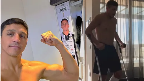 Alexis deja atrás las muletas para volver a la canchas.