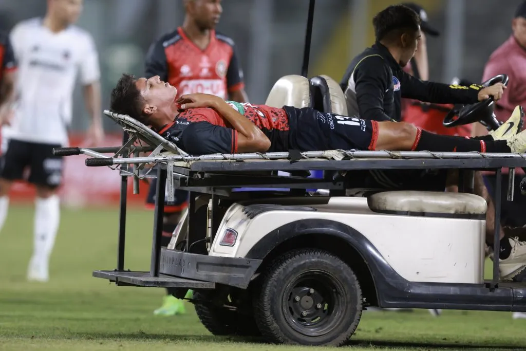 Francisco Romero salió así tras un choque fortuito en una disputa. (Felipe Zanca/Photosport).