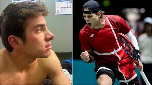 Zizou Bergs no dudó en realizar grave acusación contra Garin.