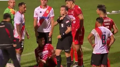 Rodrigo Orellana sufrió una grave lesión en el duelo ante Curicó Unido.