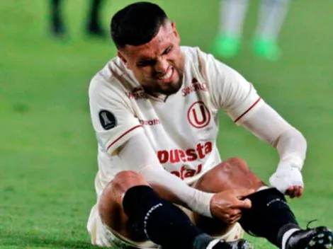 Impactante: Rodrigo Ureña muestra su mano tras fuerte pisotón