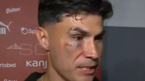 Así quedó Pablo Galdames tras el empate 1-1 entre Independiente y Racing de Avellaneda.