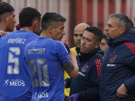 ¿Cambia formación? Las 3 bajas que enfrenta Álvarez vs Cobresal