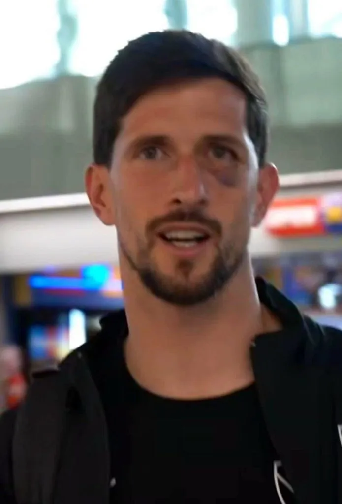 Rodrigo Rey con el ojo morado: ojo que va con casco contra la U.