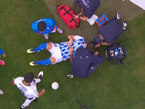 Horror: ¡Jugador de la UC queda sangrando tras ser impactado por proyectil!