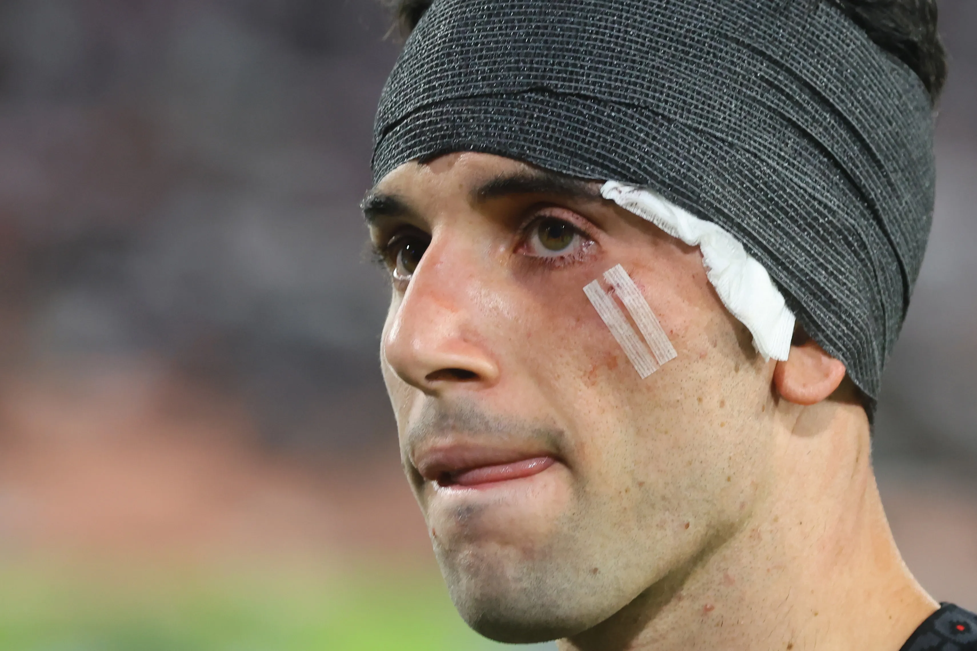 Así quedó Lautaro Pastrán luego de la Noche Alba Solidaria.(Foto: Jonnathan Oyarzun/Photosport)