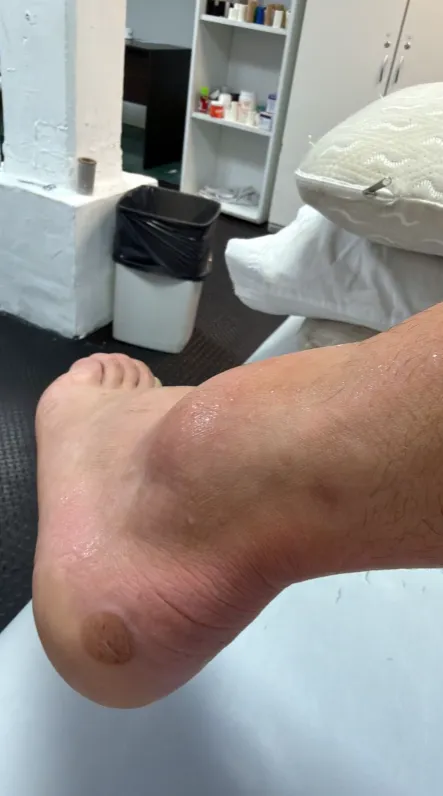 El tobillo de Adrián Martínez. (Captura Twitter).