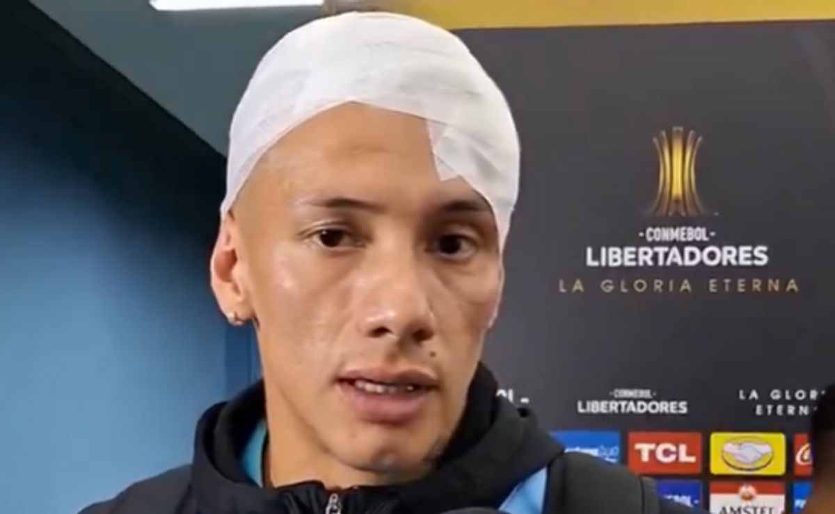 Capitán de O’Higgins quedó así tras el duelo ante Tolima: “El corte era muy profundo, pero…”