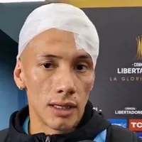 Capitán de O'Higgins quedó así vs Tolima: "El corte era muy profundo, pero..."