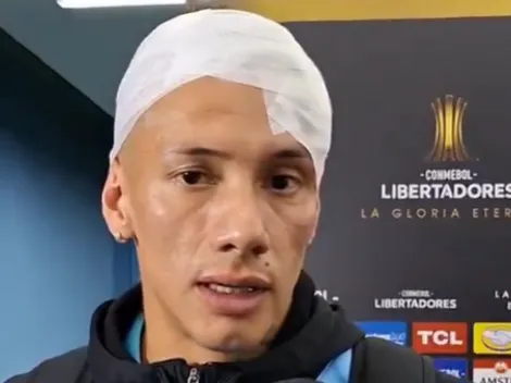 Capitán de O'Higgins quedó así vs Tolima: "El corte era muy profundo, pero..."