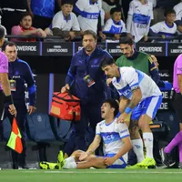 Sonó en Colo Colo, se puso bótox y es el enemigo número uno de la UC