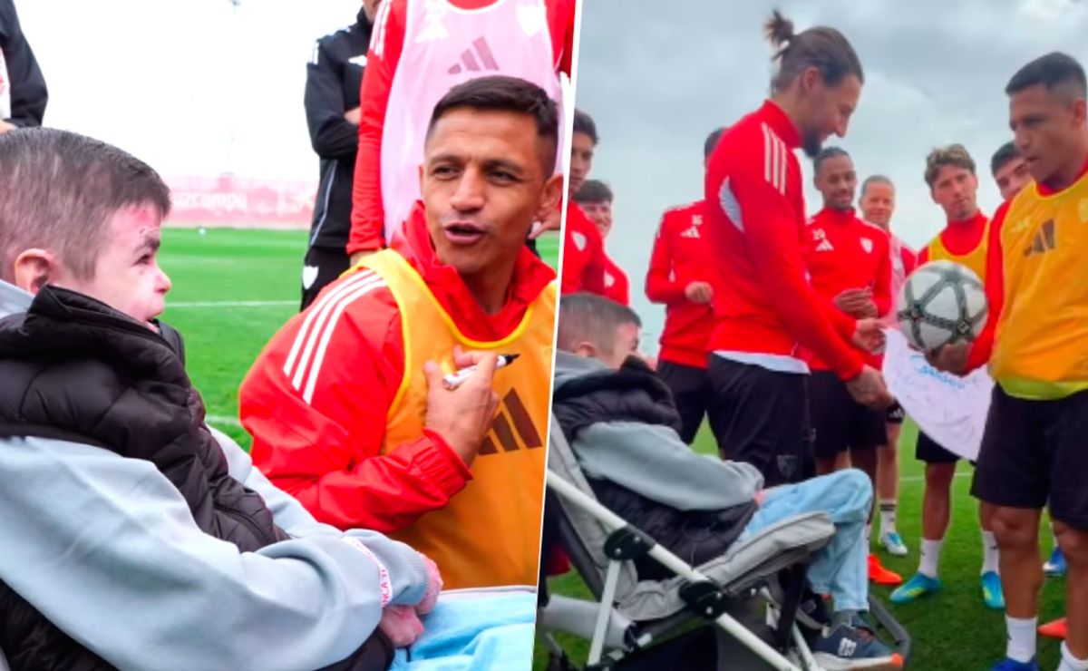 “Un luchador”: El noble gesto de Alexis Sánchez con pequeño que sufre de Piel de mariposa