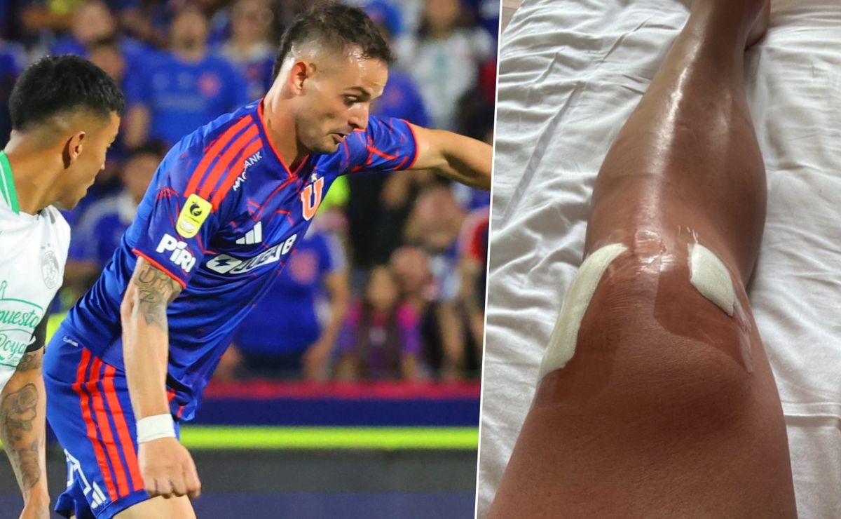 Octavio Rivero reaparece tras su operación en U de Chile: rompe el silencio en sus redes