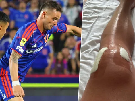 Octavio Rivero rompe el silencio tras la operación en la U