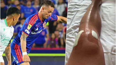 Octavio Rivero fue operado el pasado miércoles.