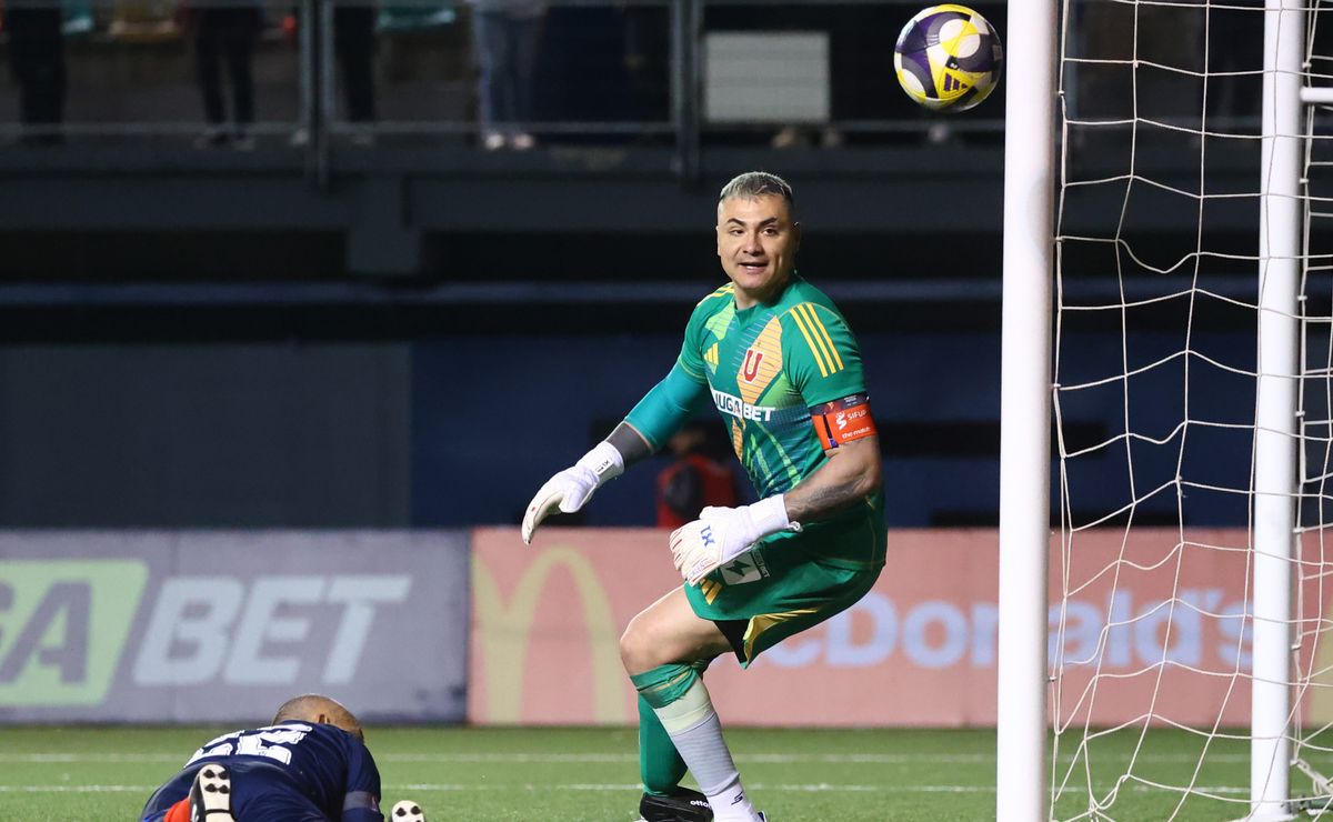 Los detalles de la prótesis de Cristóbal Campos para regresar al fútbol en Glorias Navales