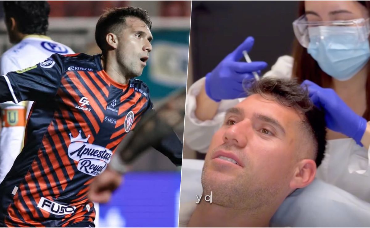 César Fuentes se sincera sobre su tratamiento: “El pelo me generó gran inseguridad”