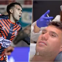 César Fuentes se sincera sobre su tratamiento: "Me generó inseguridad"