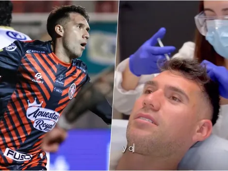 César Fuentes se sincera sobre su tratamiento: "Me generó inseguridad"