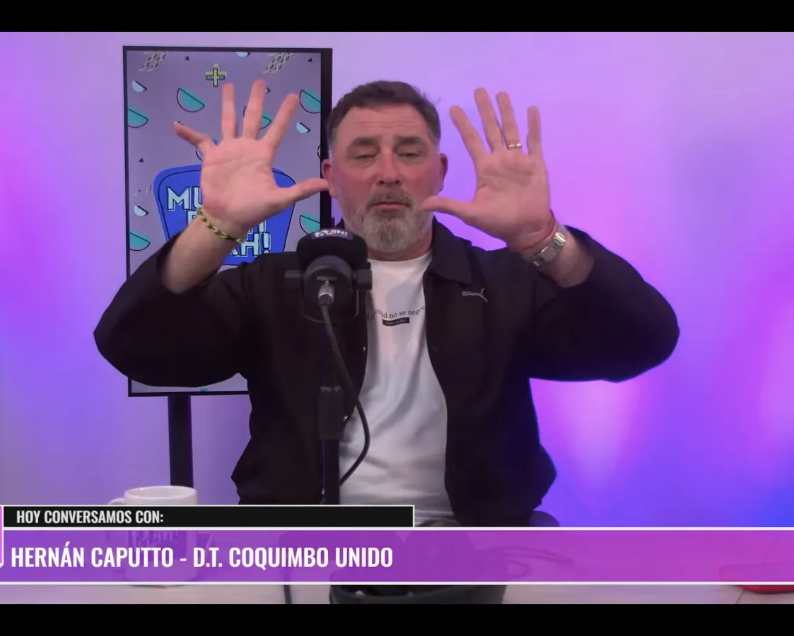Hernán Caputto explicó su lesión en el meñique de la mano derecha.