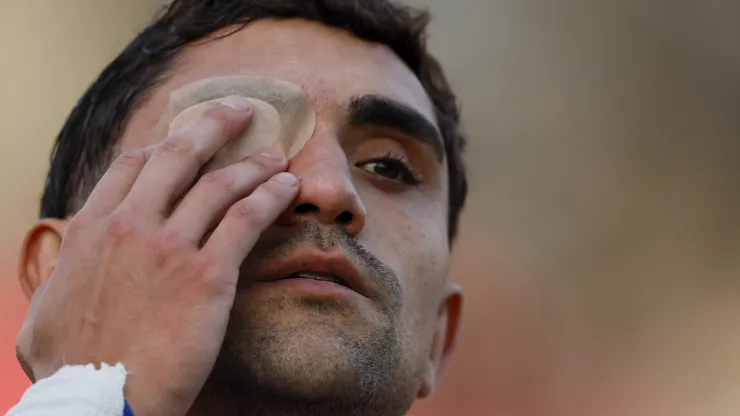 Nicolás Ramírez terminó con un parche en el ojo en la U.