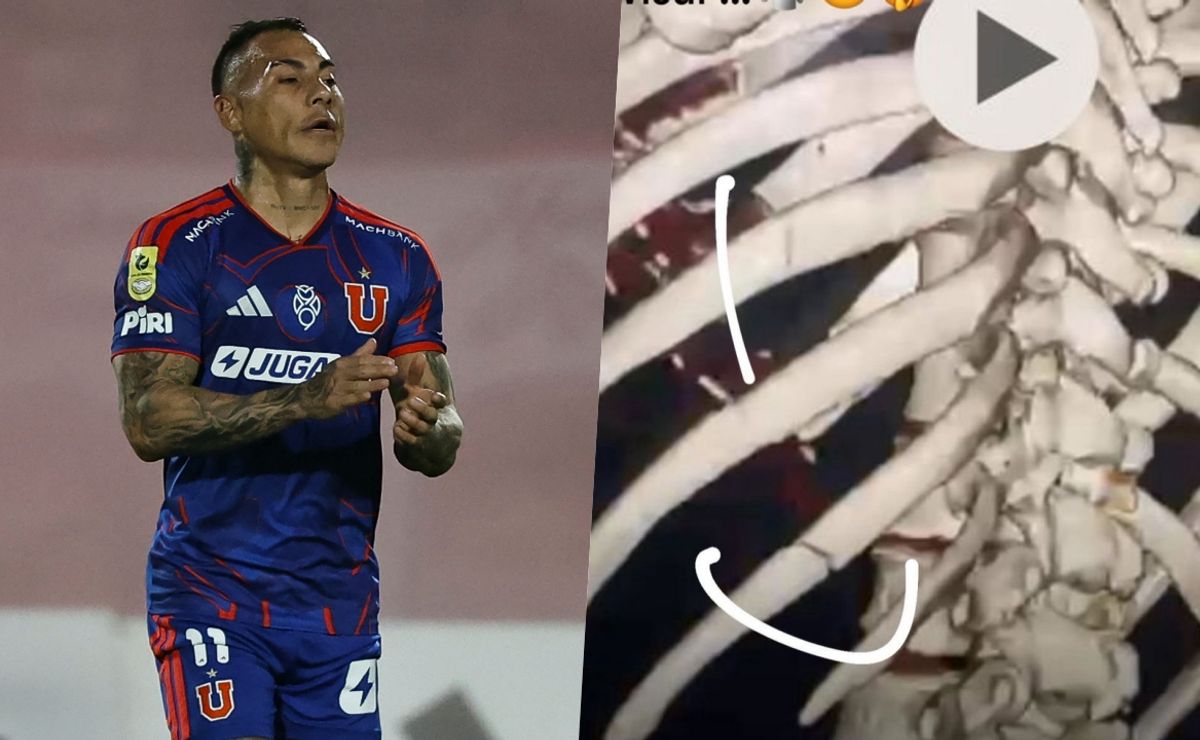 “Dos fracturas en las costillas”: el furioso reclamo de Eduardo Vargas en U. de Chile