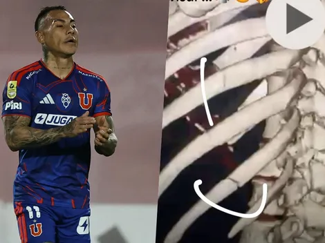 "Dos fracturas": el furioso reclamo de Eduardo Vargas en U. de Chile