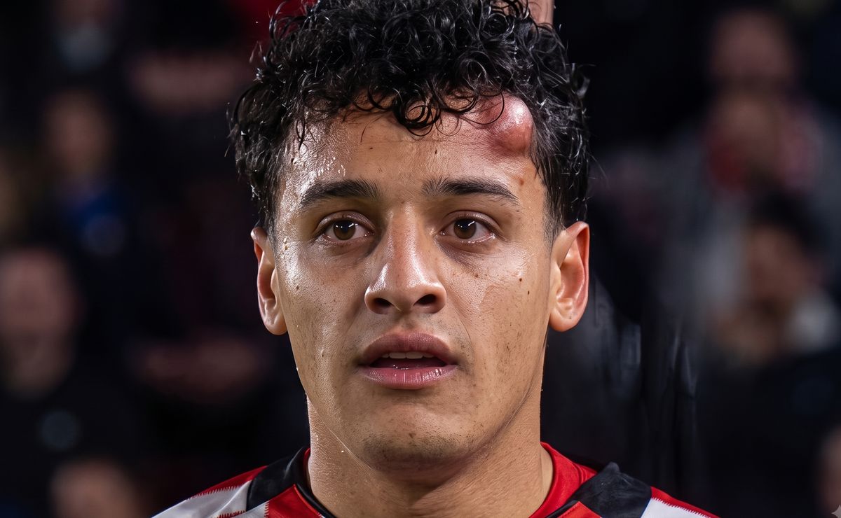 Tiago Palacios quedó así en el partido vs Católica y esto dijo el DT de Estudiantes: “No estaba bien”