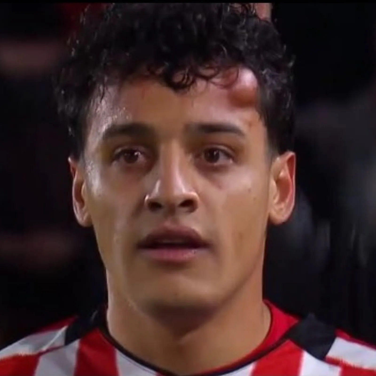 Así quedó Tiago Palacios tras el golpazo con el colombiano Valencia. (Captura ESPN).