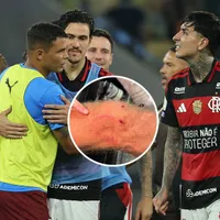 Destruyen a Pulgar tras criminal patada en Clásico: "Juego desleal"
