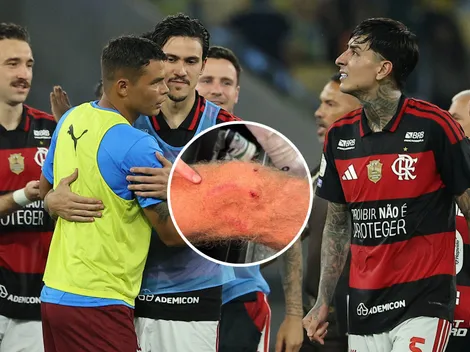 Destruyen a Pulgar tras criminal patada en Clásico: "Juego desleal"
